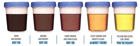 Colon Prep Color Chart