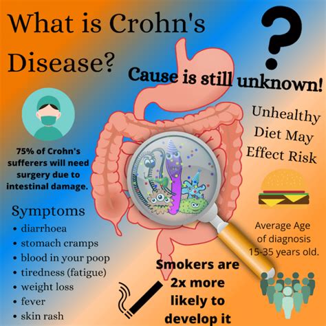 Crohns And Cbd Oil Understanding The Benefits Of Cannabis - 