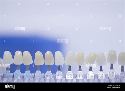 Crown Tooth Color Chart
