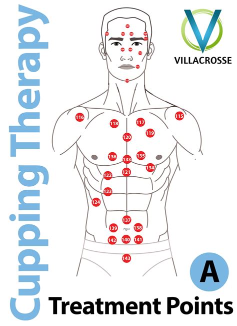 Cupping Therapy Placement Chart
