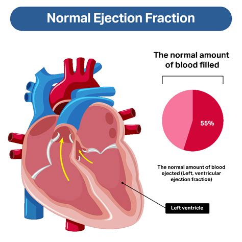 Ejection Fraction Chart