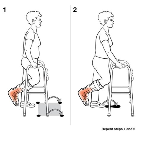 Embracing Mobility: Can You Use a Walker for Non-Weight Bearing?