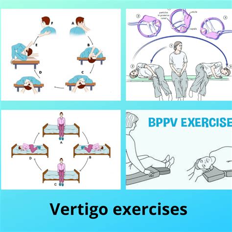 Epley Maneuver Vertigo Exercise Chart