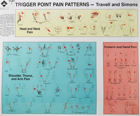 Facial Trigger Points Chart