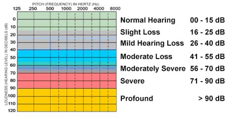Hearing Loss Db Chart