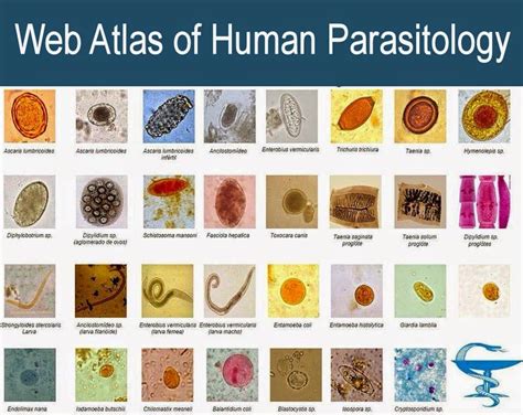 Human Parasite Identification Chart
