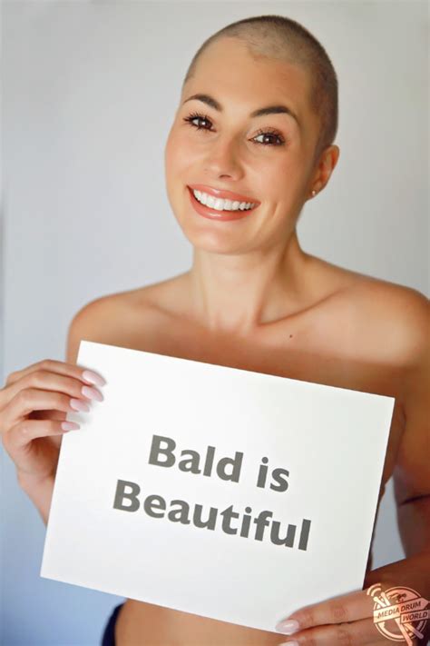 Ice Spice Bald: A Comprehensive Guide