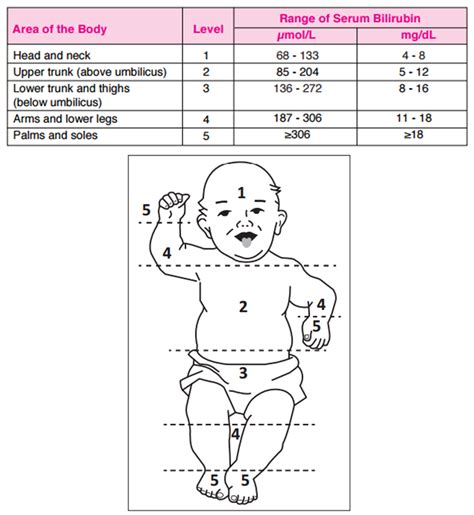 Jaundice Levels Chart