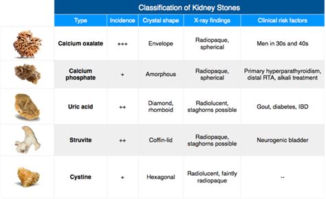 Kidney Stones Sizes Chart