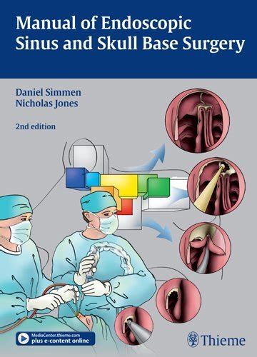 Manual Of Endoscopic Sinus Surgery Simmen Daniel Jones Nick S