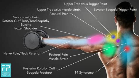 Muscle Pain Location Chart