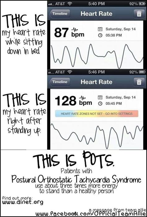 Pots Heart Rate Chart