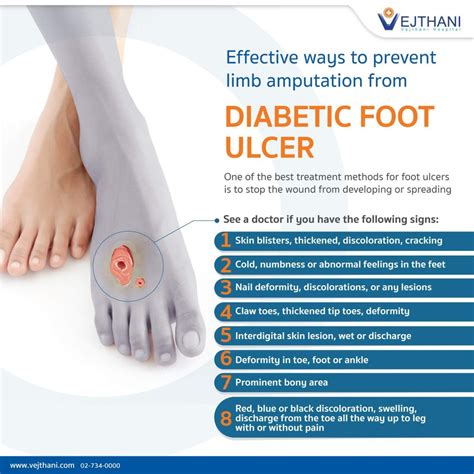 Preventing Foot Ulcers in Patients with Diabetes book cover