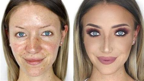Sculptra Ansikte: Förvandla Ditt Utseende Utan Operation