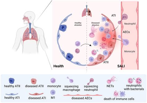 Sepsis-induced Acute Lung Injury [microform] : the Role of Endogenous and Exogenous Nitric Oxide book cover