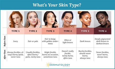 Skin Type Chart