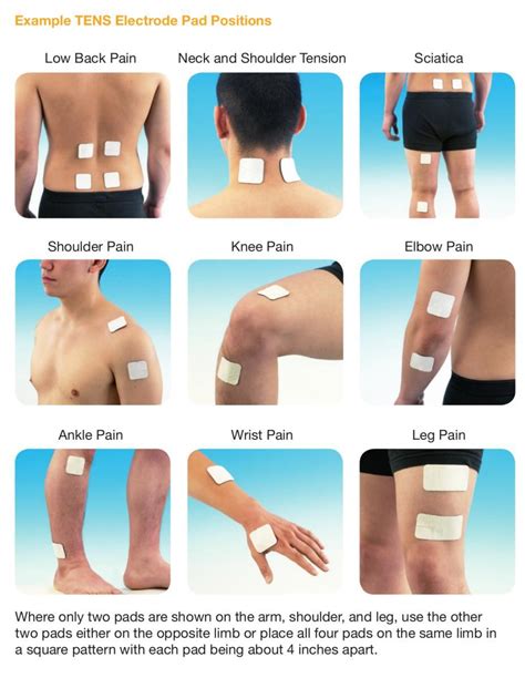 Tens Electrode Placement Chart Shoulder
