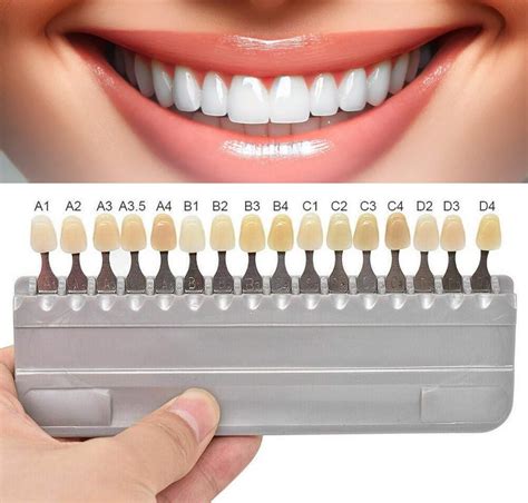 Tooth Shades Chart