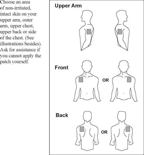 Transdermal Patch Placement Chart