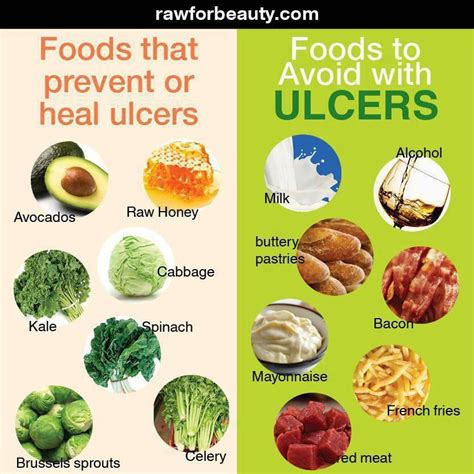Ulcer Patient Diet Chart