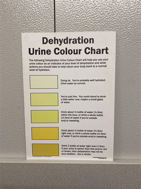 Urinal Chart