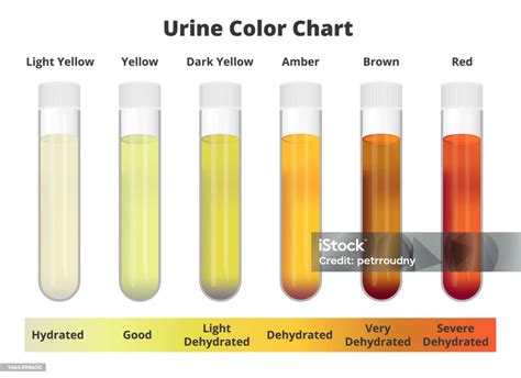 Urine Test Color Chart