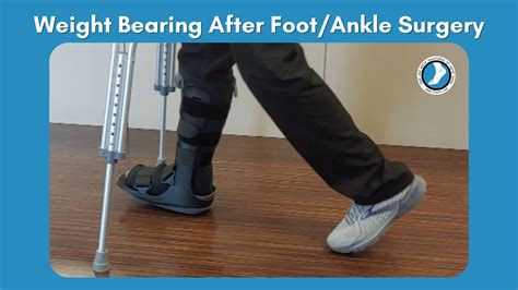 Weight Bearing After Ankle Fracture Surgery: A Step-by-Step Guide to Recovery