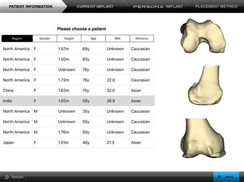 Zimmer Persona Sizing Chart