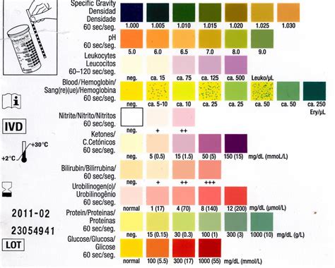 Abnormal Urine Test Results Chart