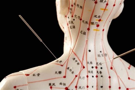 akupunktur växjö