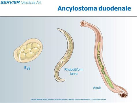 ancylostoma duodenale diagram 