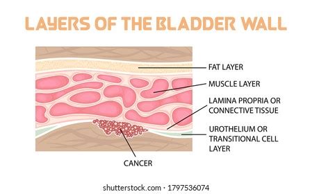 bladder wall diagram 