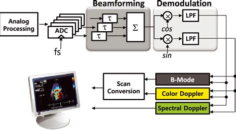 block diagram ultrasound machine 