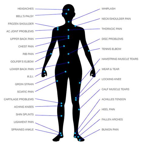 body part diagram for workplace injuries 