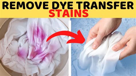 clothes dye on skin, What to do when your clothes leave dye on skin