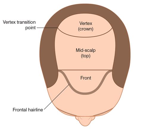 crown head diagram 