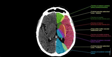 ct brain anatomy atlas, Brain atlas of human anatomy with mri