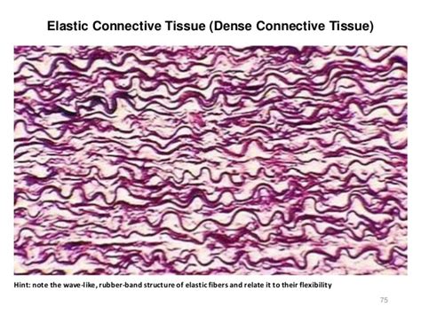 diagram of elastic tissue 
