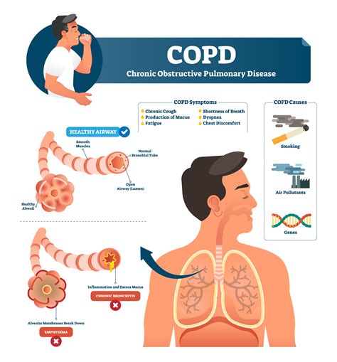 diagram of lung copd 
