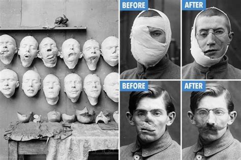 disfigurement mask