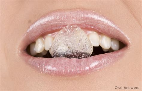 does chewing ice hurt teeth