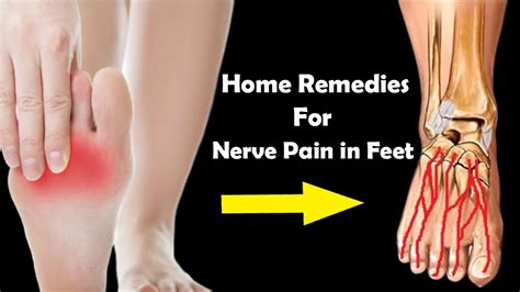 does ice help nerve pain in feet