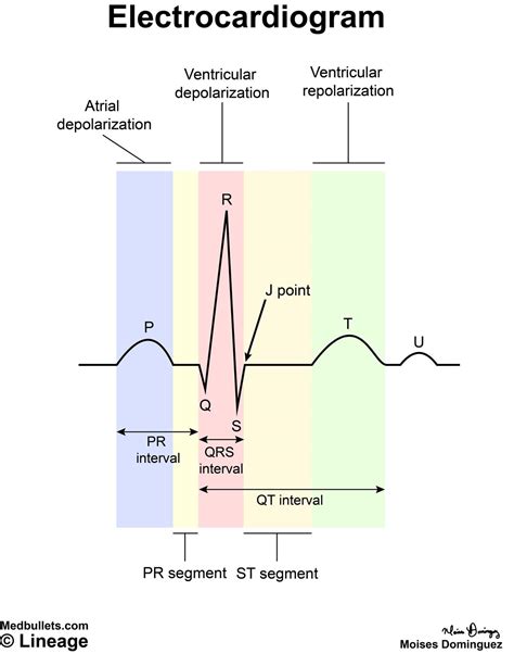 electrocardiogram diagram 