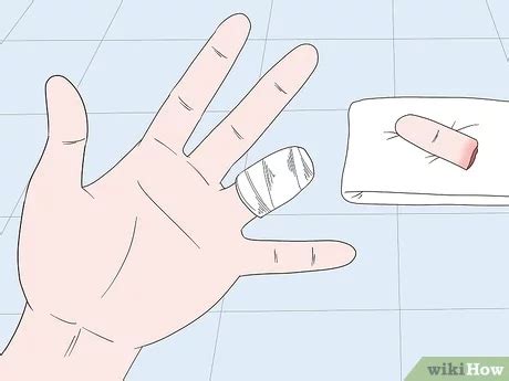 finger cut off front view, Hand with top of one finger cut off