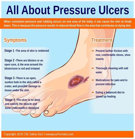 foot diagram pressure ulcer 