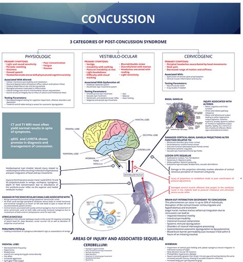 frisättning Concussion