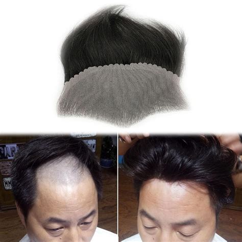 hair piece for receding hairline