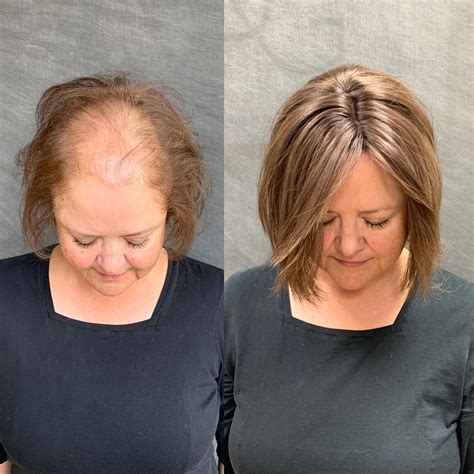 hair pieces for thinning hair on crown