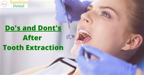 heat or ice after tooth extraction