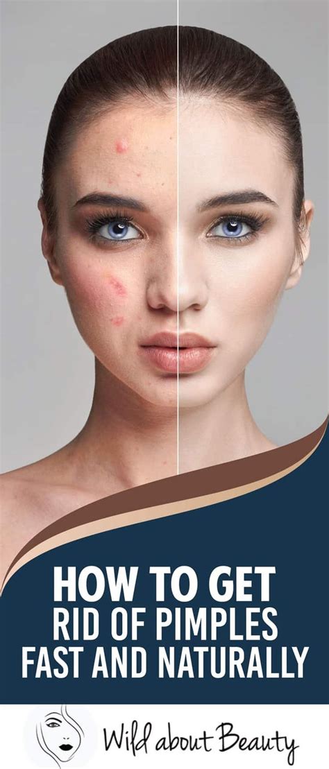 how to get rid of pimples fast, Ways to eliminate pimples overnight? (naturally and fast. Rid pimples overnight forehead naturally pimple acne fast warts